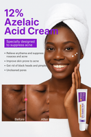 Azelaic Acid 12% Dark Spot Correcting Gel with Vitamin C & Niacinamide - Brightening Treatment for Even Skin Tone
