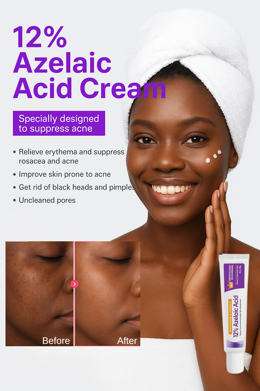 Azelaic Acid 12% Dark Spot Correcting Gel with Vitamin C & Niacinamide - Brightening Treatment for Even Skin Tone