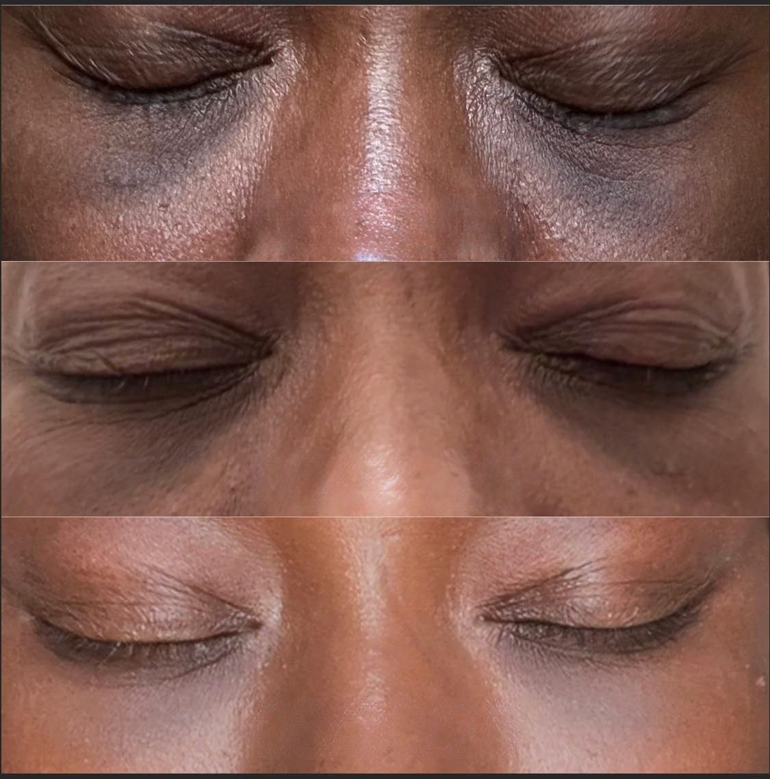 Mzansi Radiance Azelaic Acid Gel