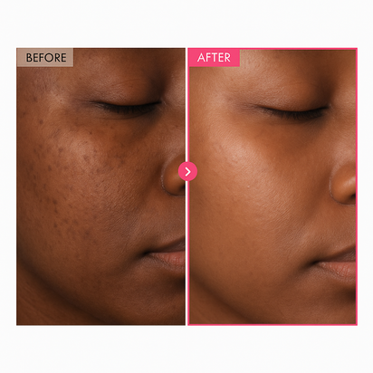 TOSOWOONG Arbutin 7% + Tranexamic Acid 4% Cream