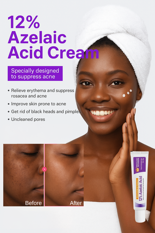 Azelaic Acid 12% Dark Spot Correcting Gel with Vitamin C & Niacinamide - Brightening Treatment for Even Skin Tone