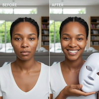 Radiance Pro LED Mask